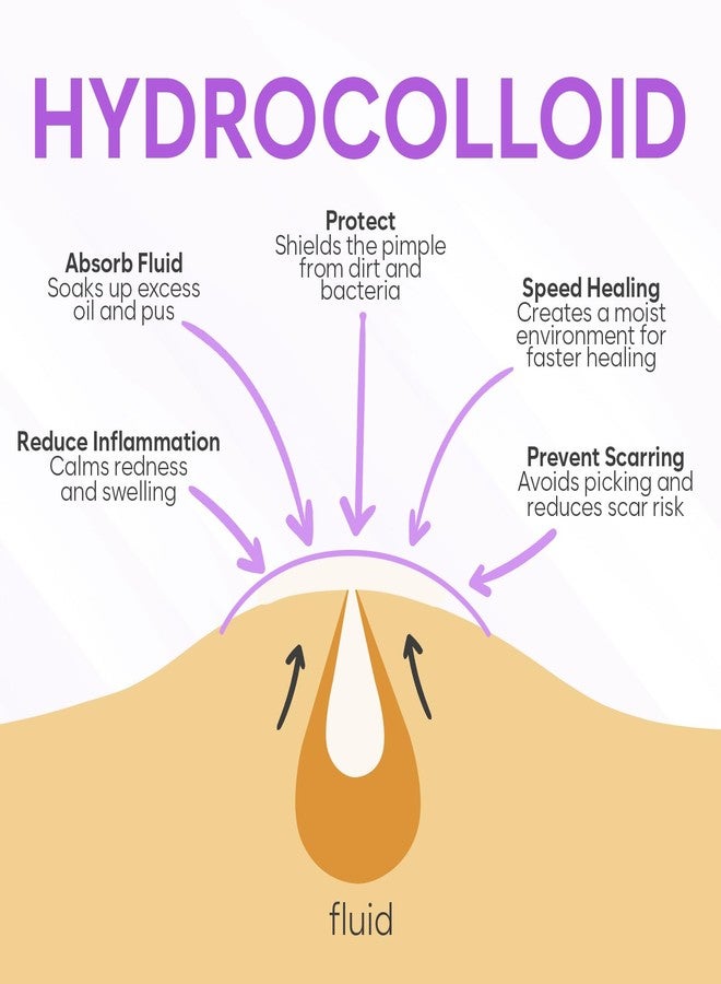 BLOOMORA Invisible Pimple Patches for Face (324 Count), Zit Patches for Spot Cover, Hydrocolloid Covers Pimples, Clear (2 Sizes - S/L) - Image 2